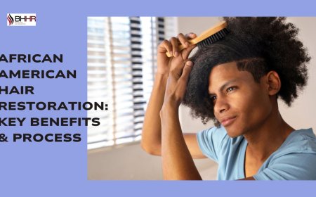African American Hair Restoration: Key Benefits & Process