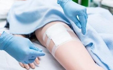 The Role of a Wound Care Specialist in Managing Pressure Ulcers