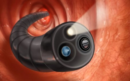Colonoscopy Devices Market Opportunities Fueled by Rising Colorectal Screenings