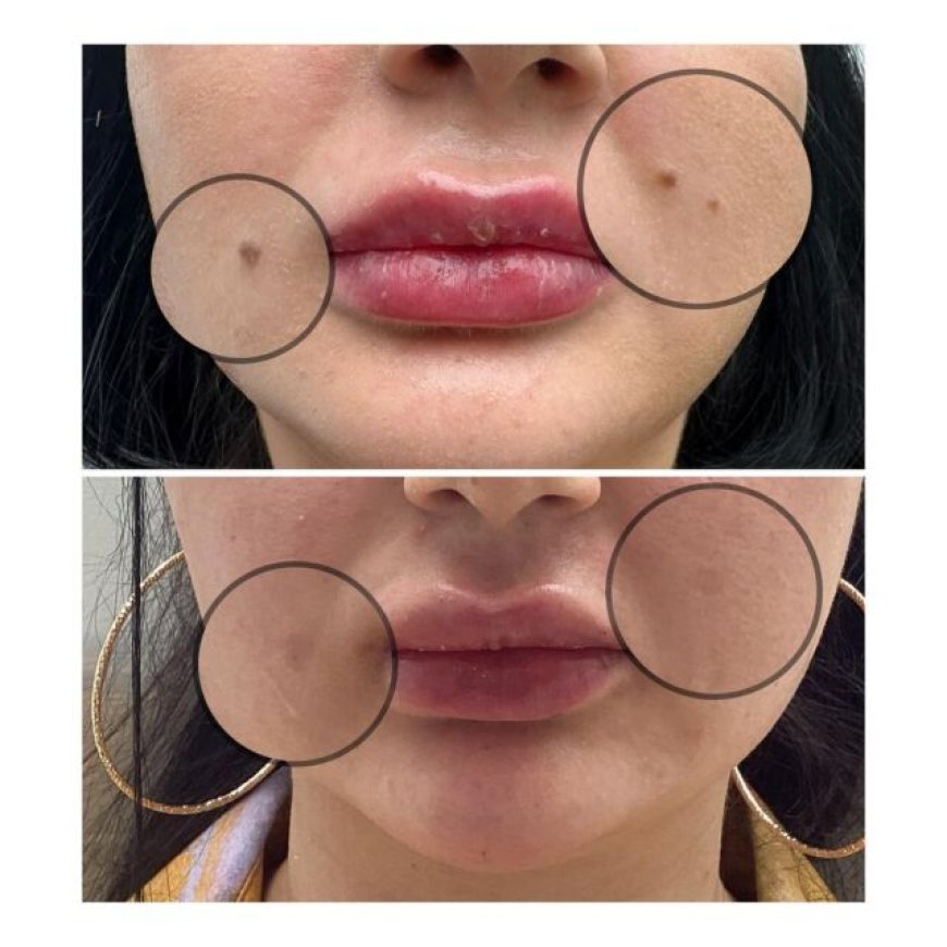 Discover Your Best Skin A Guide to Choosing a Skin Clinic in Richmond